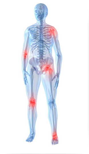 I più diffusi dolori alle articolazioni